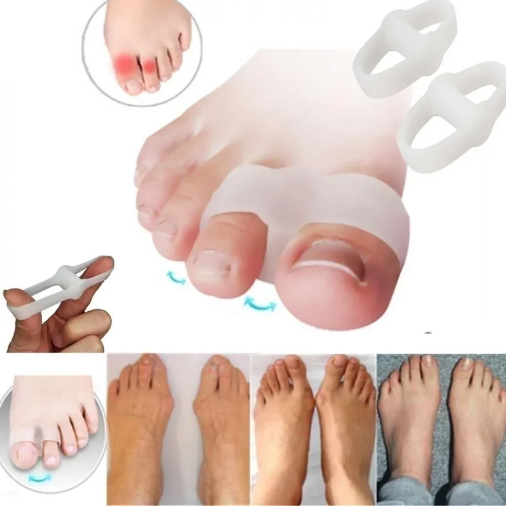 2-gaats bunion corrector pijnv - Correction Fluid White recensie en prijs